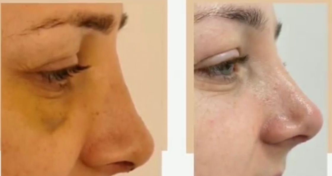 Facial Surgery